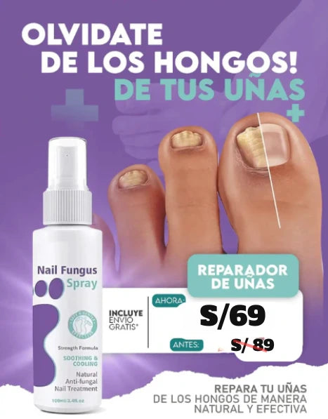 SPRAY PARA ELIMINAR HONGOS
